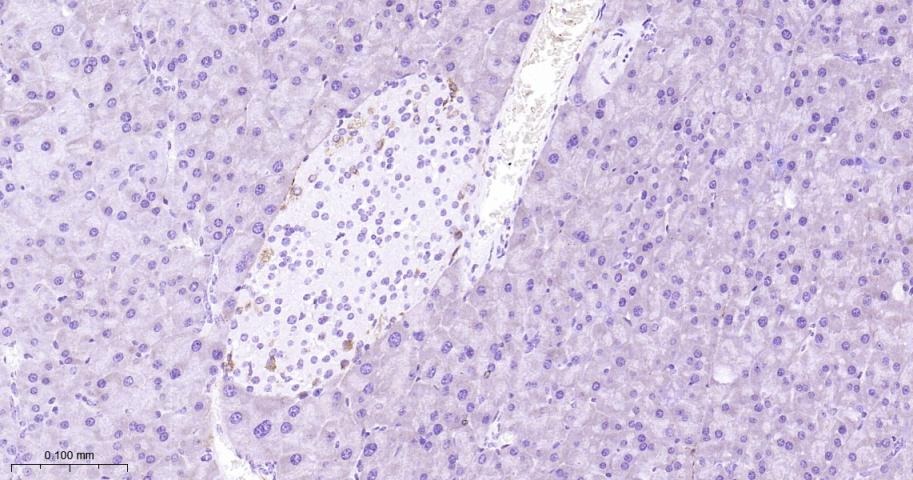 Anti-FAP Polyclonal Antibody 2