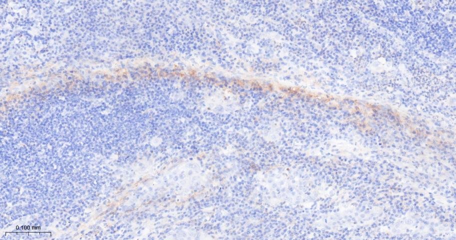 Anti-FAP Polyclonal Antibody 2