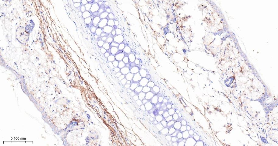 Anti-FAP Polyclonal Antibody 2
