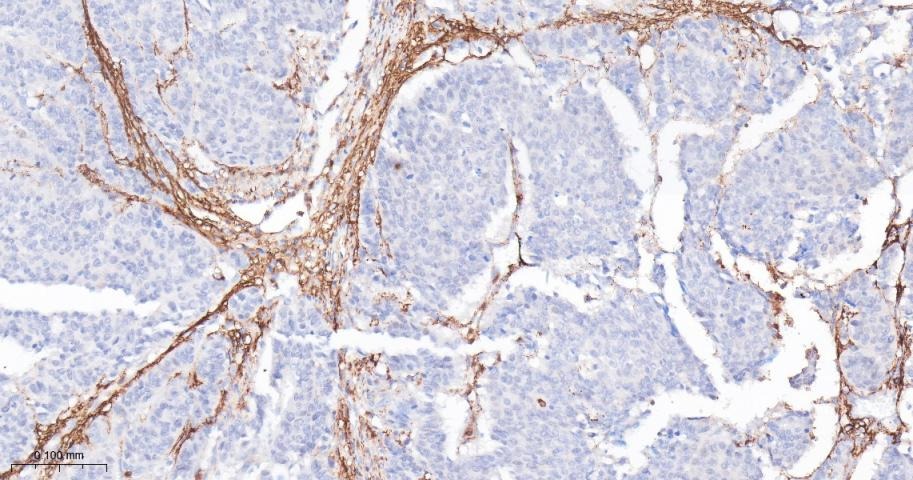 Anti-FAP Polyclonal Antibody 2