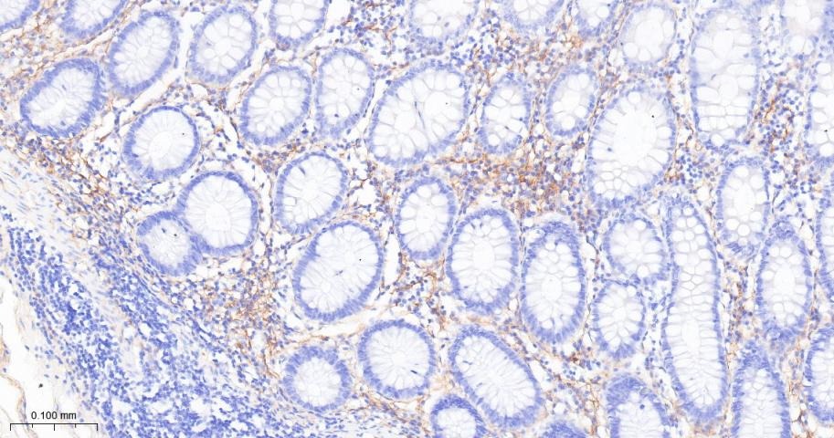 Anti-FAP Polyclonal Antibody 2