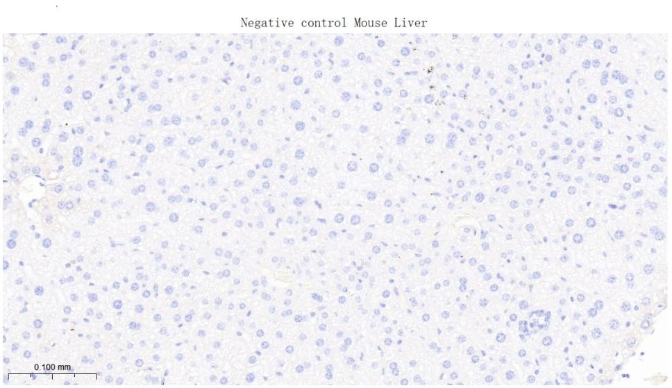 Anti-FAP Polyclonal Antibody 2