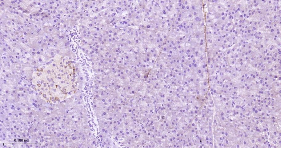 Anti-FAP Polyclonal Antibody 2