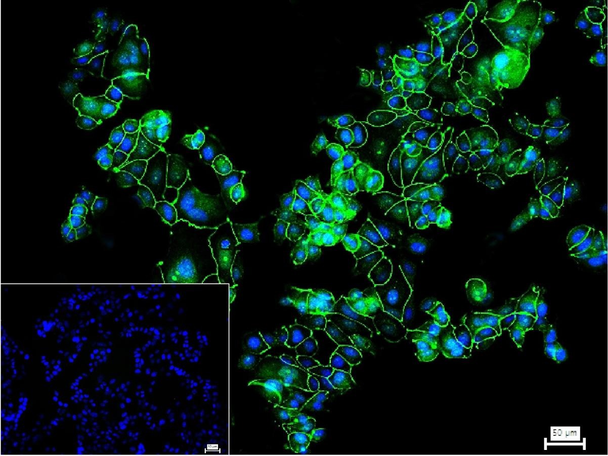 Anti-ZO-1/TJP1 Polyclonal Antibody