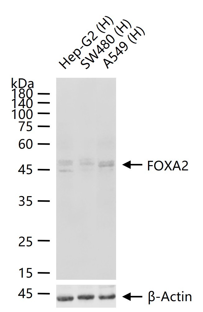 Anti-FOXA2 Polyclonal Antibody