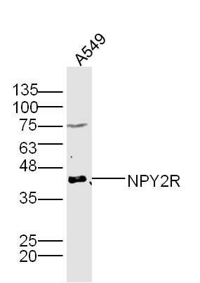 Anti-NPY2R Polyclonal Antibody