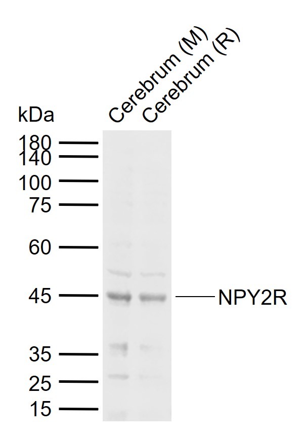 Anti-NPY2R Polyclonal Antibody