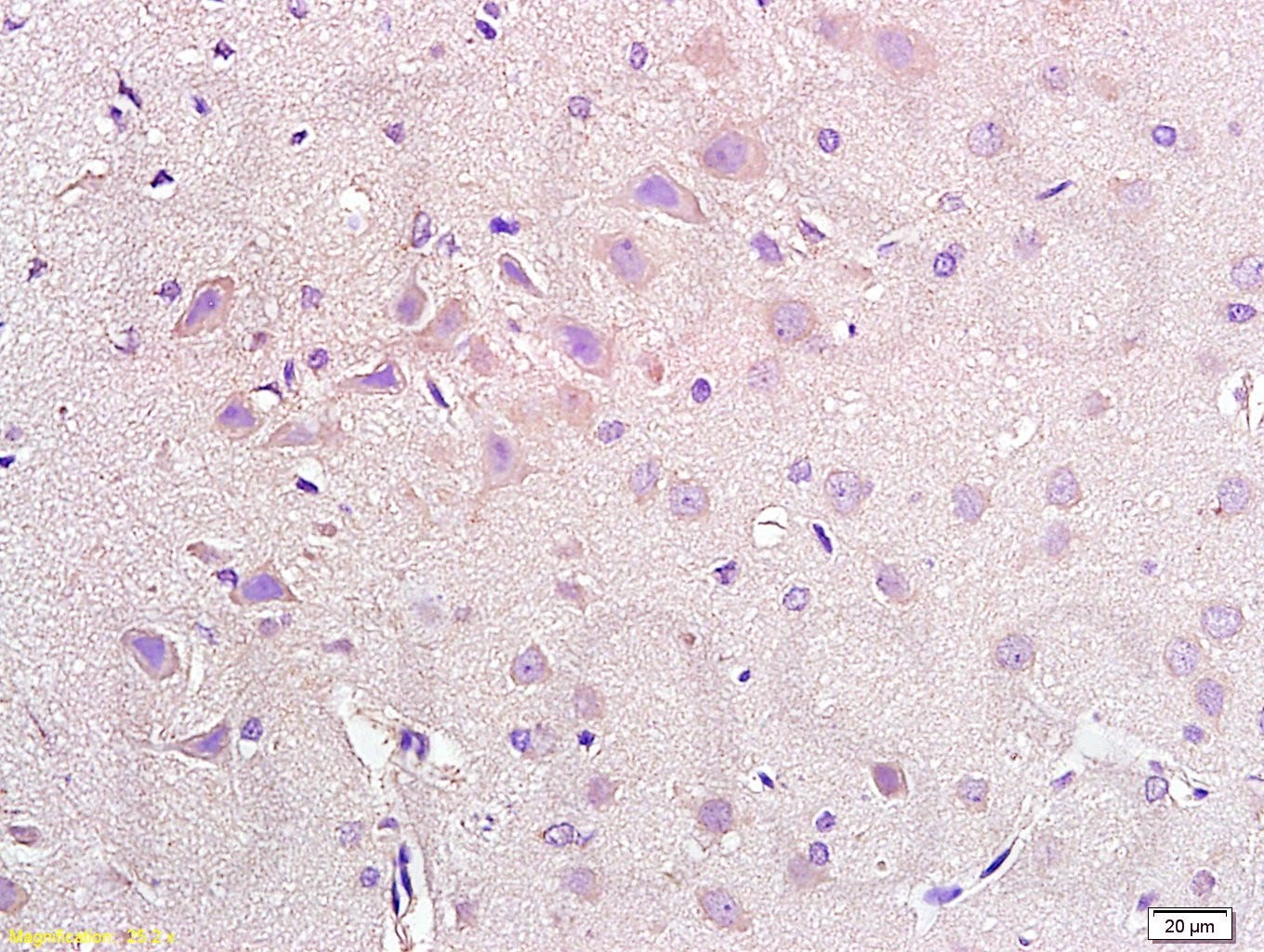 Anti-NPY2R Polyclonal Antibody