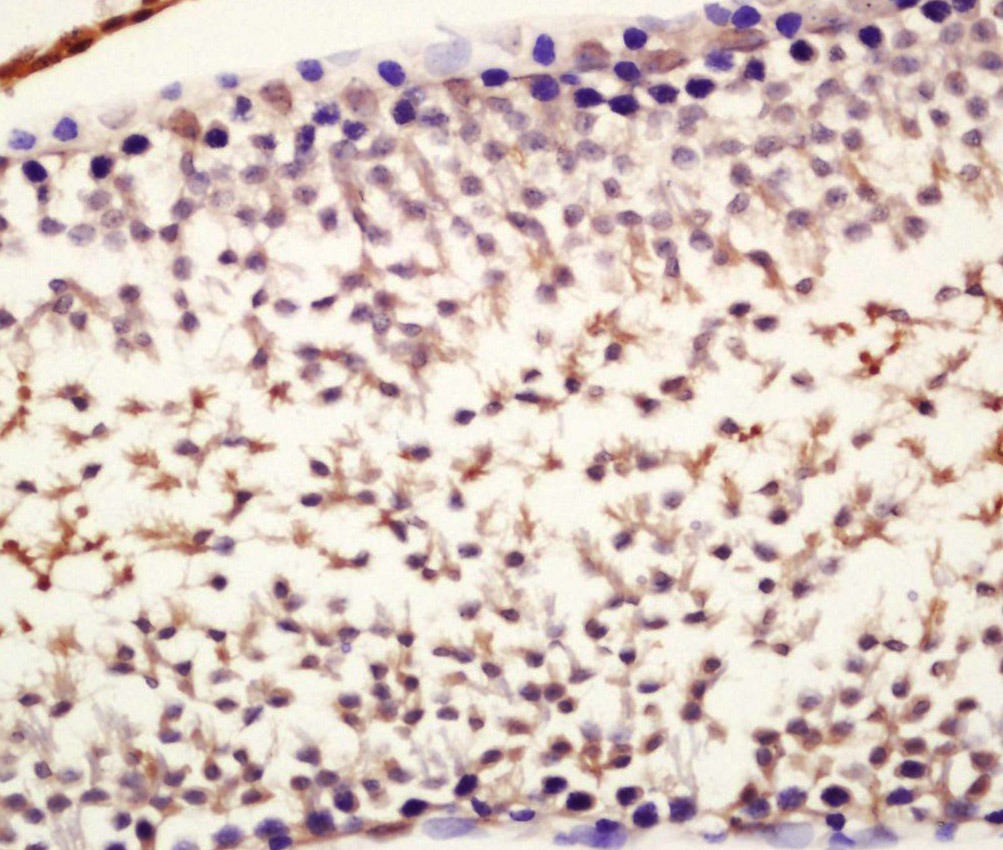 Anti-NANOG Polyclonal Antibody 2