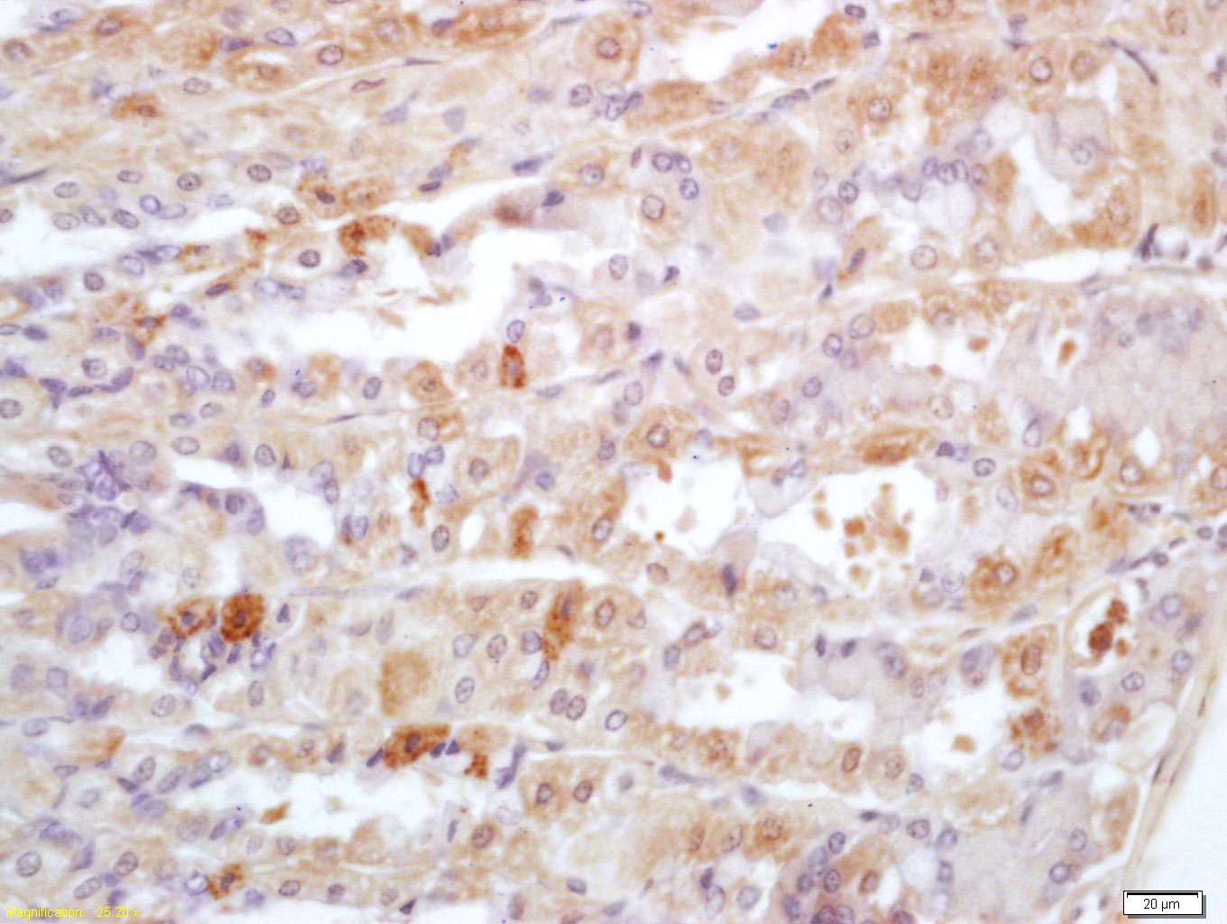Anti-FGFBP1 Polyclonal Antibody