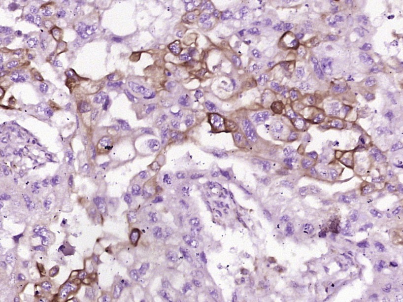 Anti-FGFBP1 Polyclonal Antibody