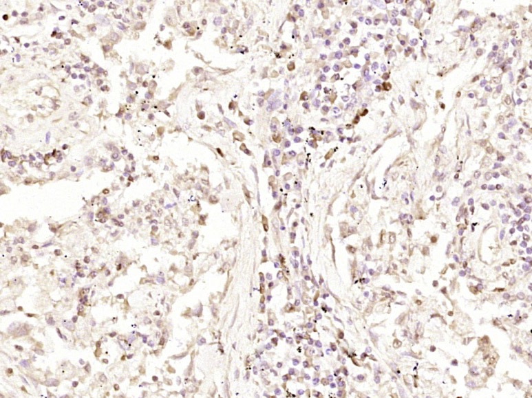 Anti-SMAD3 Antibody (5O254)