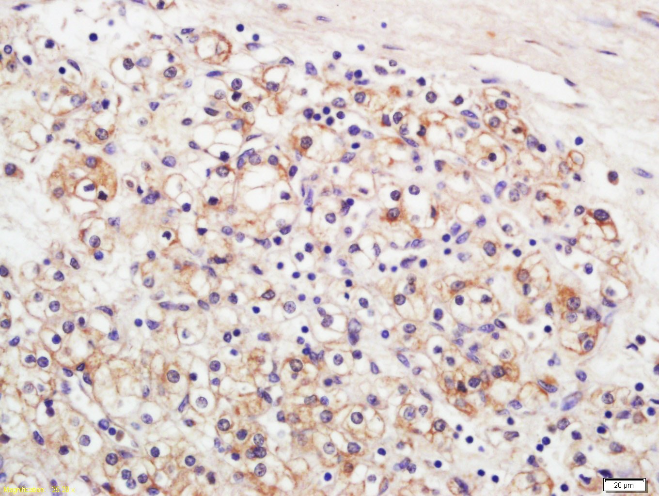 Anti-Claudin-5 Polyclonal Antibody 2