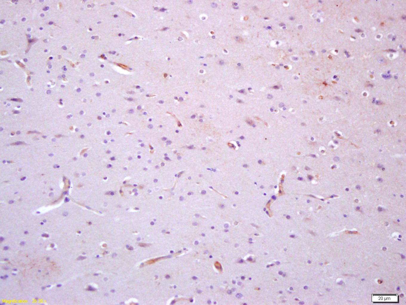 Anti-TIE1 Polyclonal Antibody