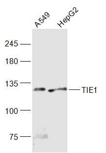 Anti-TIE1 Polyclonal Antibody