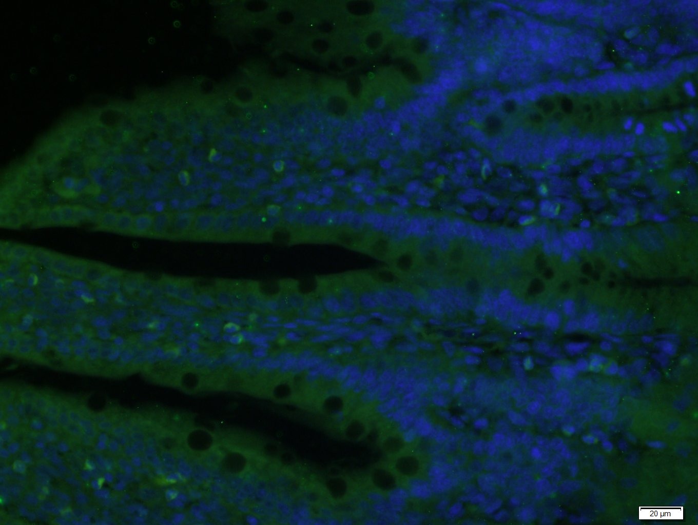 Anti-TET3 Polyclonal Antibody