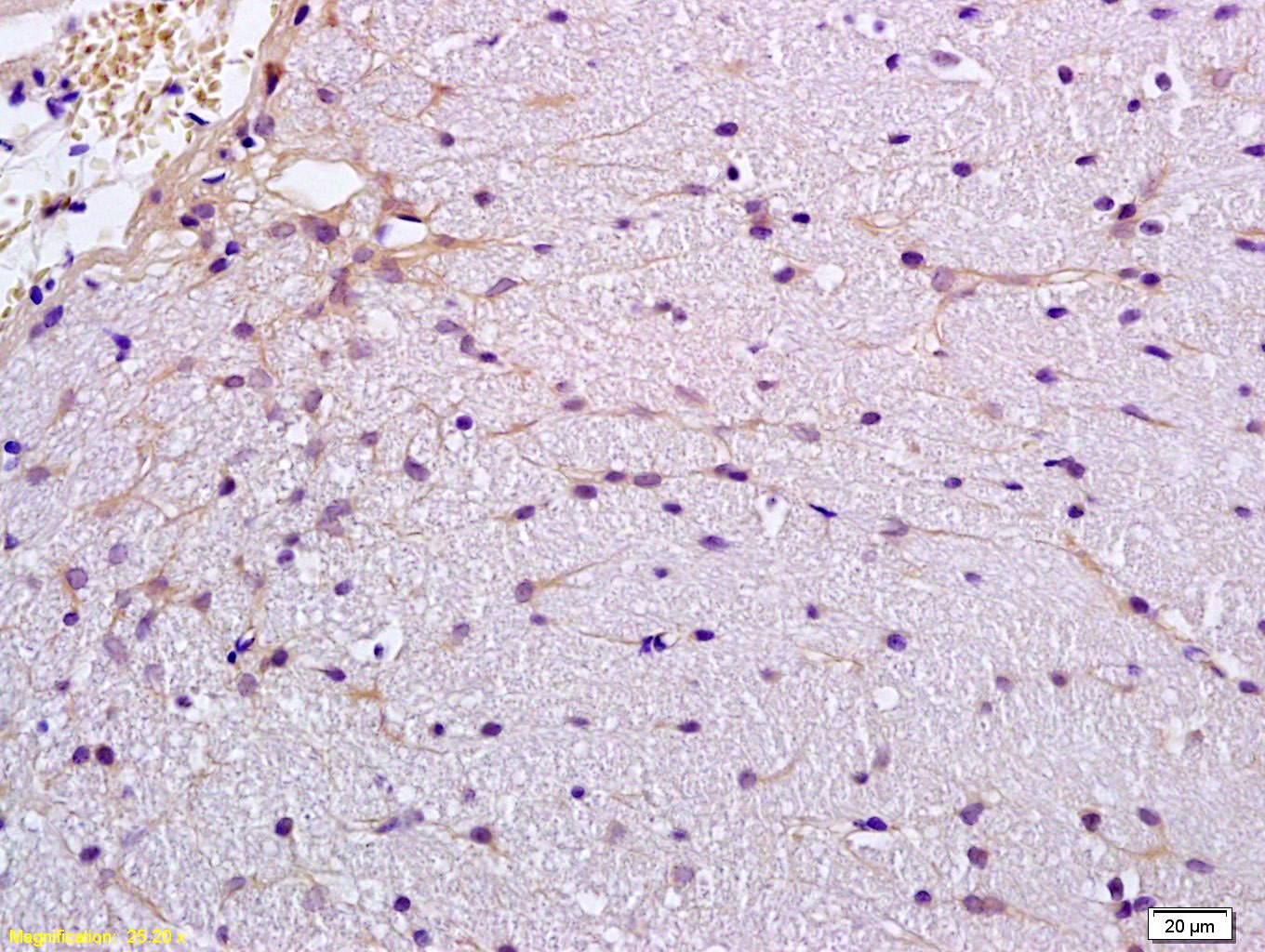 Anti-Claudin-5 Polyclonal Antibody 2