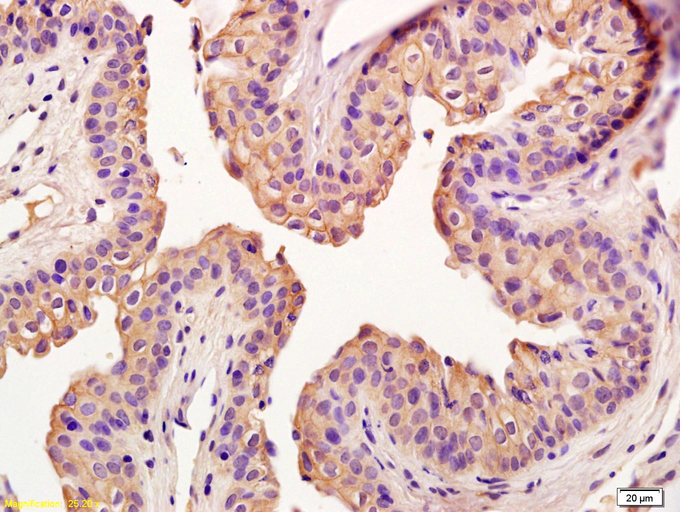 Anti-Claudin-5 Polyclonal Antibody 2