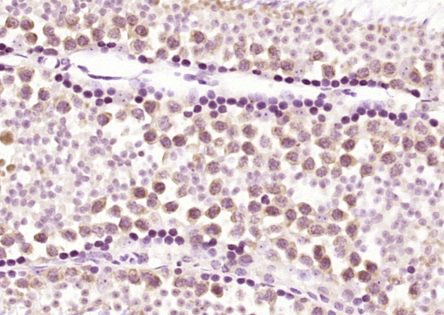 Anti-TET3 Polyclonal Antibody