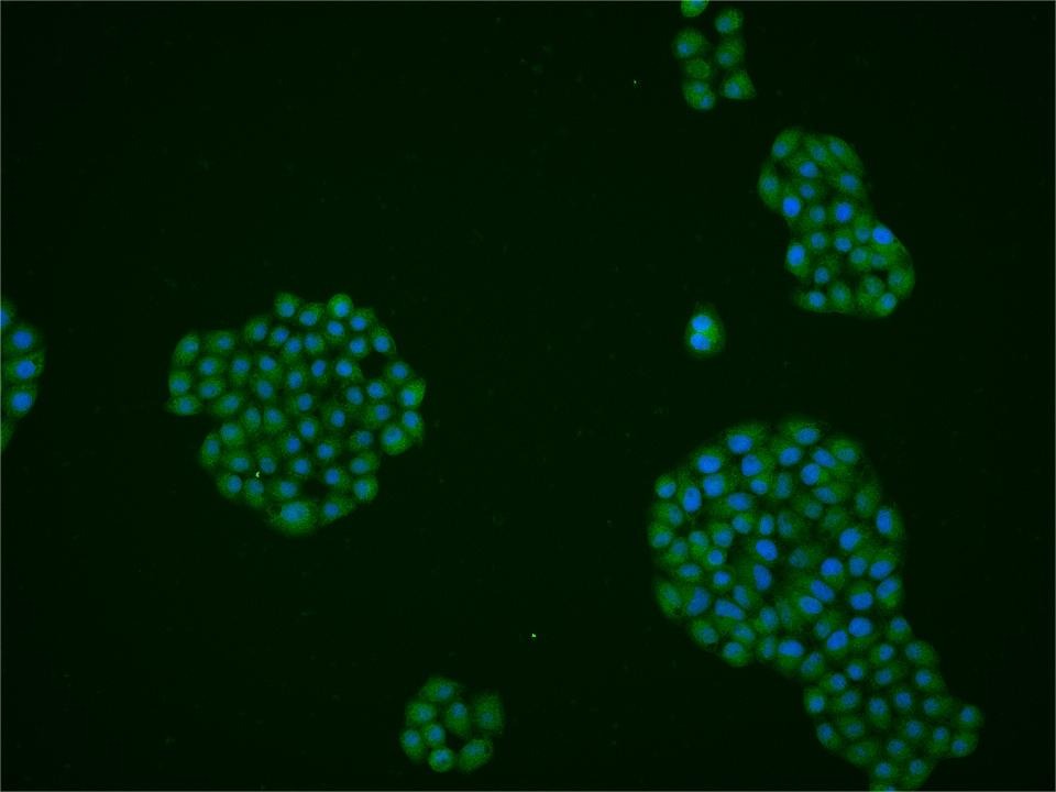 Anti-TET3 Polyclonal Antibody