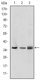 Anti-PINCH Monoclonal Antibody (2L620)