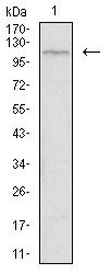 Anti-TIE1 Monoclonal Antibody (9H277)