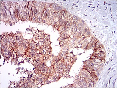 Anti-TIE1 Monoclonal Antibody (9H277)