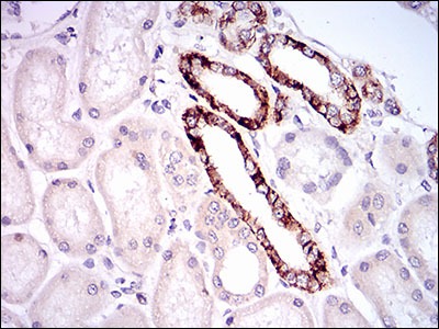 Anti-TIE1 Monoclonal Antibody (9H277)