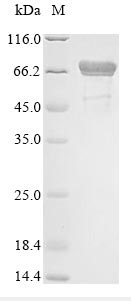 Chaperone Protein DnaK, Recombinant, E. coli, aa1-638, His-Tag