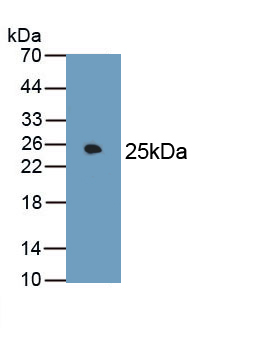 Fibronectin