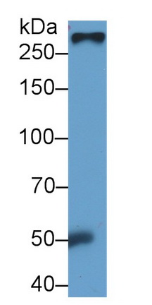 Fibronectin