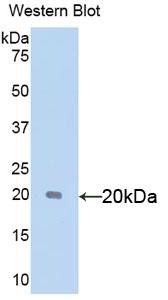 Sex Hormone Binding Globulin