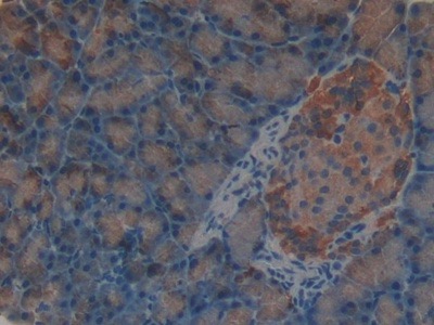 Sex Hormone Binding Globulin