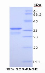 Insulin Like Growth Factor 1