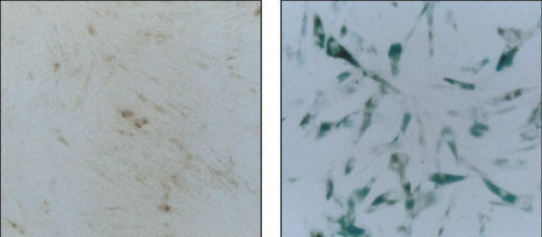 &beta;-Galactosidase Staining Kit, BioAssay&trade;