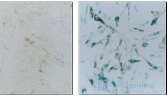 &beta;-Galactosidase Staining Kit, BioAssay&trade;