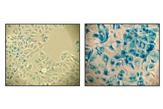 &beta;-Galactosidase Staining Kit, BioAssay&trade;