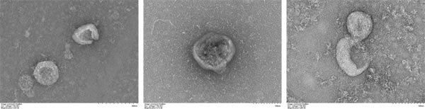 Cell Supernatant Exosome Isolation BioAssay&trade; Kit