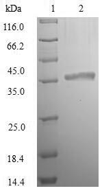 LdcA, Recombinant, E. coli, aa1-304, His-Tag