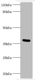 Bordetella Pertussis toxin subunit 1