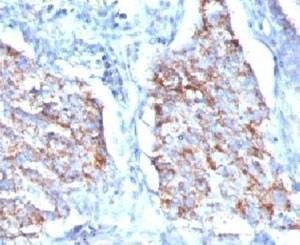 Anti-HSP60 Antibody, Sodium Azide Free