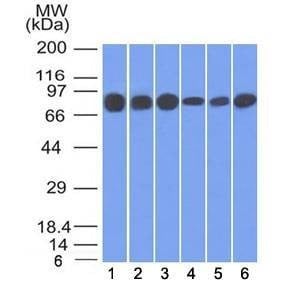 Anti-Gamma Catenin / Plakoglobin Antibody, Sodium Azide Free