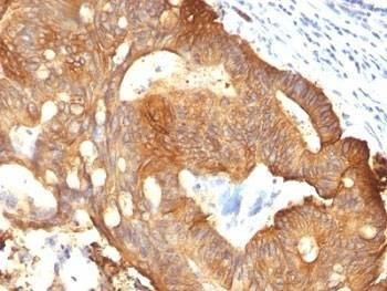Anti-Cytokeratin 8 Antibody, Sodium Azide Free