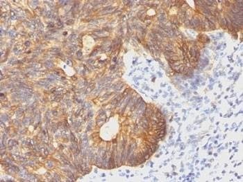 Anti-Cytokeratin 8 Antibody, Sodium Azide Free