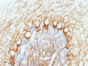 Anti-NF-H Antibody (phospho)