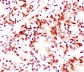Anti-Estrogen Receptor beta Antibody, Sodium Azide Free