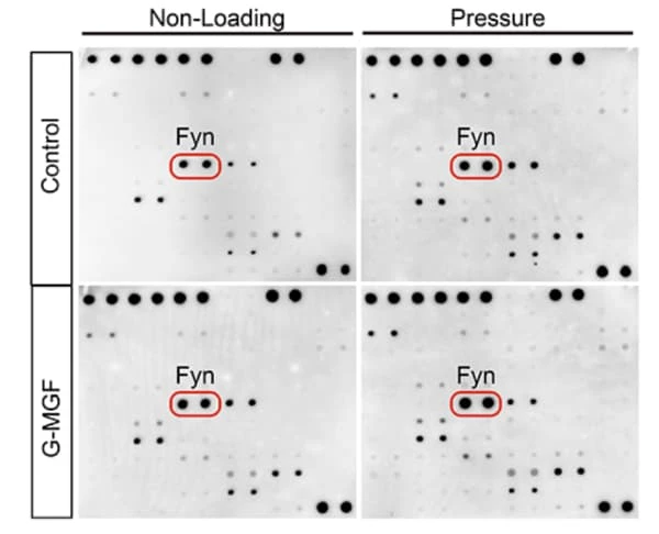 RayBiotech's Human Phospho-RTK Array identified Fyn as a key signaling molecule in mechanochemical coupling during periodontal regeneration. Figure adapted from Zhao et al., Bioengineering & Translational Medicine, 2024.