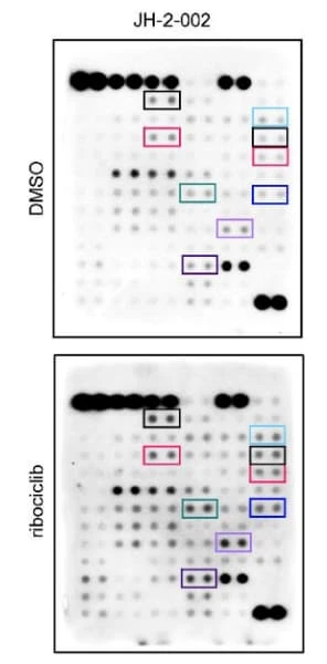 RayBiotech's Human Phospho-RTK Array was used to analyze receptor tyrosine kinase signaling in malignant peripheral nerve sheath tumors following CDK4/6 inhibition. Figure adapted from Wang et al., Science Advances, 2023.