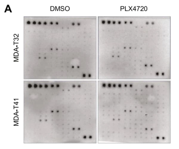 RayBiotech's Human Phospho-RTK Array was used to assess receptor tyrosine kinase activation in papillary thyroid carcinoma cells following BRAF inhibitor treatment. Figure adapted from Cavallo et al., Cell Death Discovery, 2024.