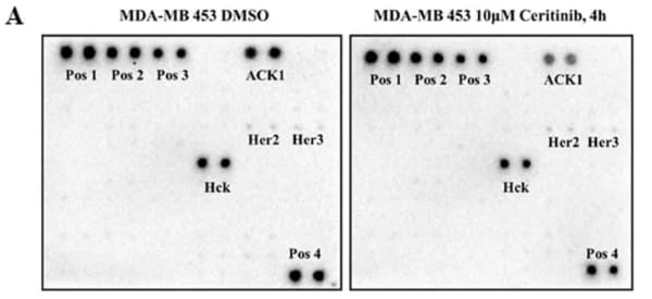 RayBiotech's Human Phospho-RTK Array was used to identify receptor tyrosine kinases targeted by ceritinib in androgen receptor-positive triple-negative breast cancer cells. Figure adapted from Dong et al., Molecular Cancer, 2022.